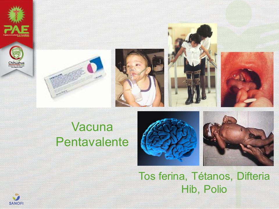 Tos ferina, Tétanos, Difteria Hib, Polio