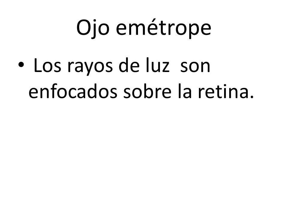 Ojo emétrope Los rayos de luz son enfocados sobre la retina.