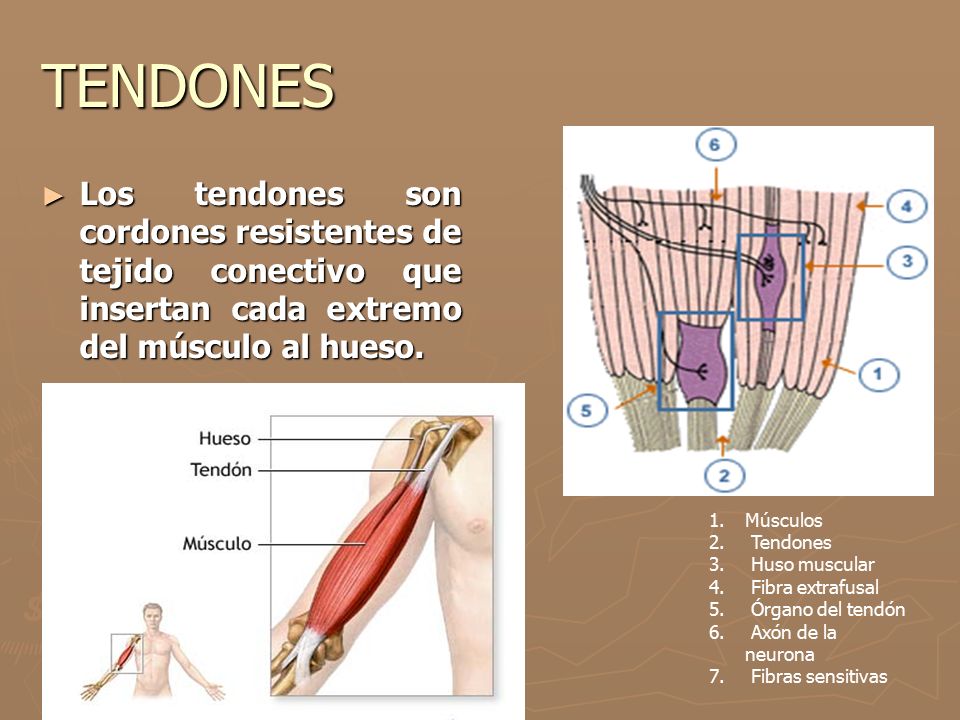 TENDONES Los tendones son cordones resistentes de tejido conectivo que insertan cada extremo del músculo al hueso.