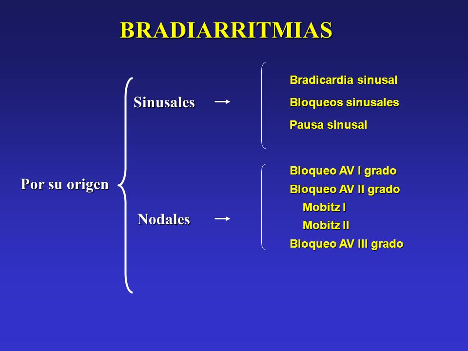 BRADIARRITMIAS Sinusales Por su origen Nodales Bradicardia sinusal