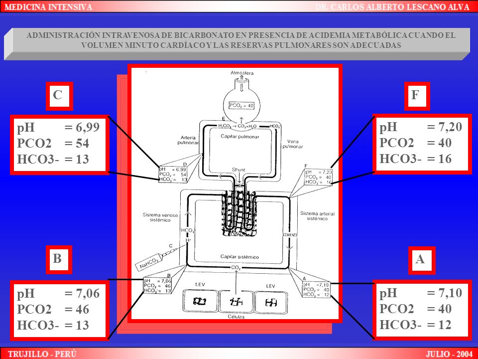 C F pH = 6,99 PCO2 = 54 HCO3- = 13 pH = 7,20 PCO2 = 40 HCO3- = 16 B A