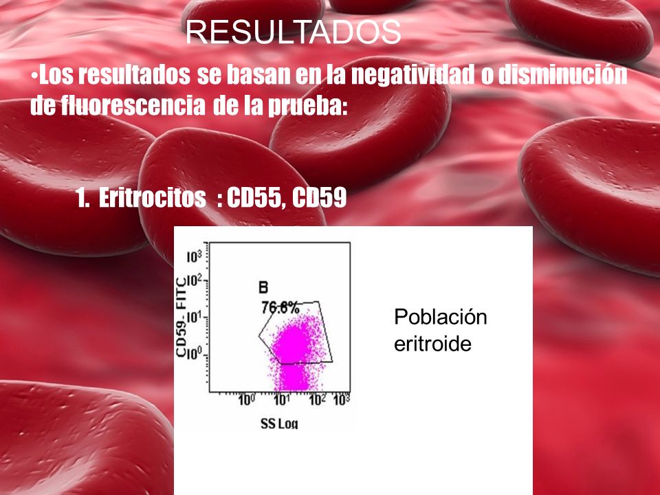 RESULTADOS Los resultados se basan en la negatividad o disminución de fluorescencia de la prueba: Eritrocitos : CD55, CD59.