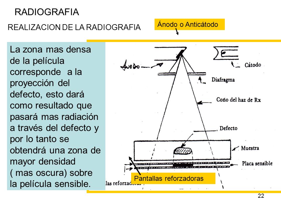 RADIOGRAFIA 27/04/2017. RADIOGRAFIA. Ánodo o Anticátodo. REALIZACION DE LA RADIOGRAFIA.