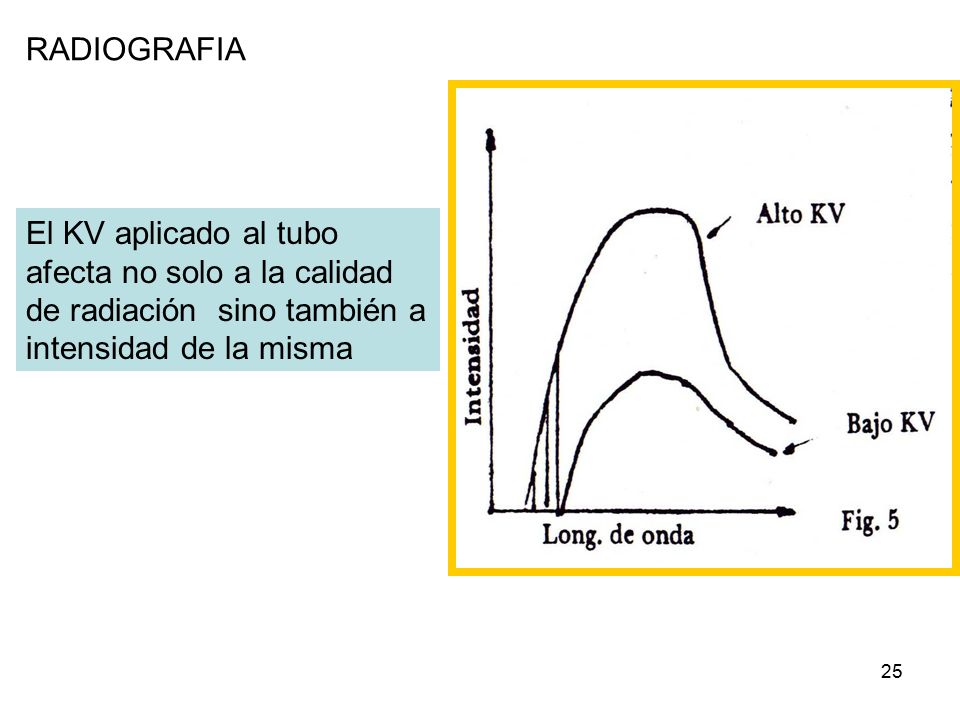 RADIOGRAFIA 27/04/2017. RADIOGRAFIA. El KV aplicado al tubo afecta no solo a la calidad de radiación sino también a intensidad de la misma.