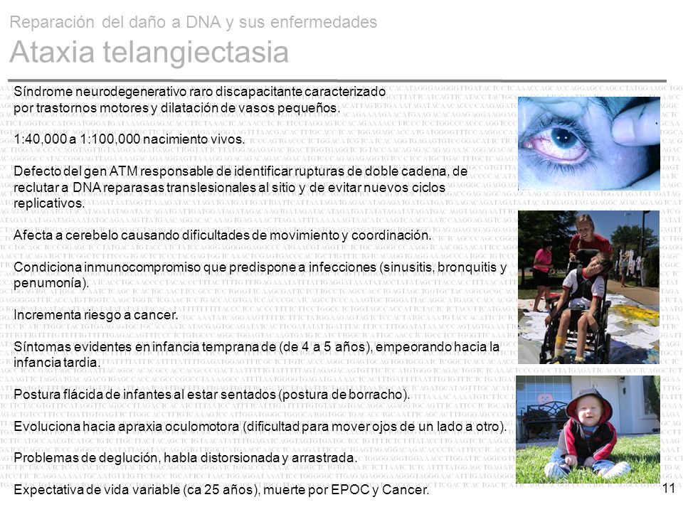 Reparación del daño a DNA y sus enfermedades Ataxia telangiectasia