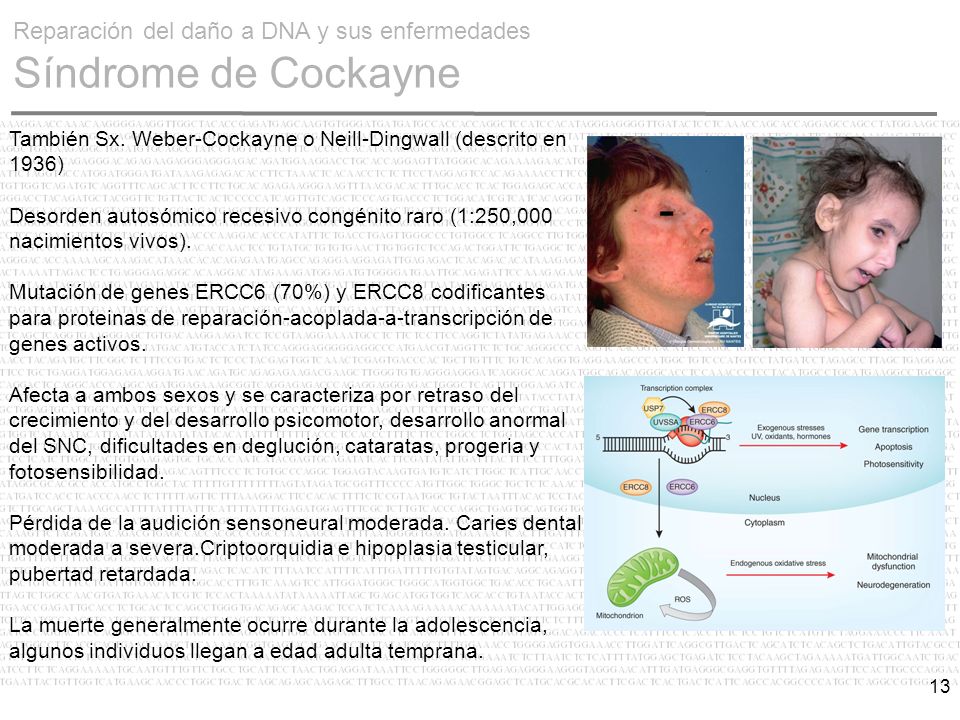 Reparación del daño a DNA y sus enfermedades Síndrome de Cockayne