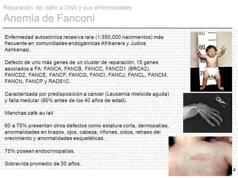 Reparación del daño a DNA y sus enfermedades Anemia de Fanconi