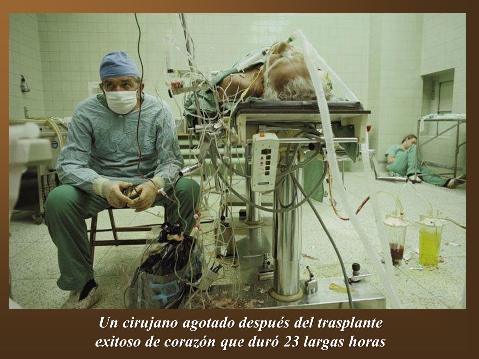 Un cirujano agotado después del trasplante exitoso de corazón que duró 23 largas horas