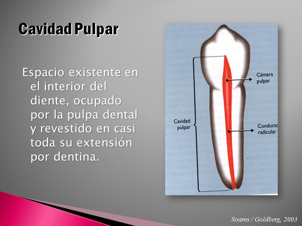 Cavidad Pulpar Espacio existente en el interior del diente, ocupado por la pulpa dental y revestido en casi toda su extensión por dentina.