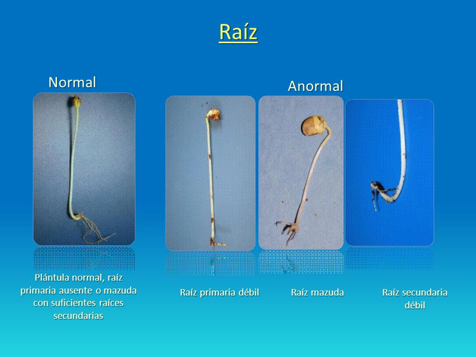 Raíz Normal. Anormal. Plántula normal, raíz primaria ausente o mazuda con suficientes raíces secundarias.