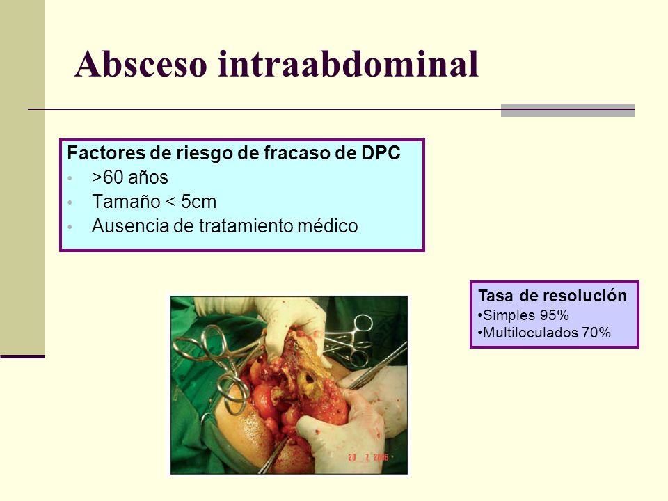 Absceso intraabdominal