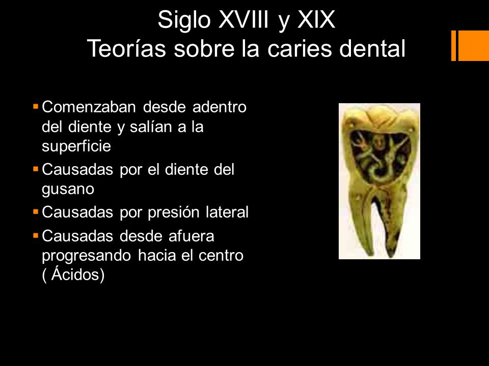Siglo XVIII y XIX Teorías sobre la caries dental