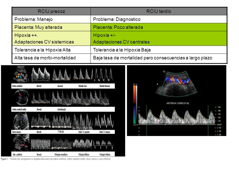 RCIU precoz RCIU tardío. Problema: Manejo. Problema: Diagnostico. Placenta: Muy alterada. Placenta: Poco alterada.