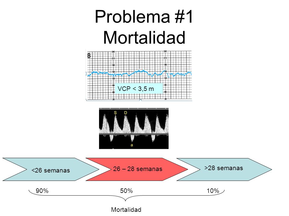 Problema #1 Mortalidad VCP < 3,5 m <26 semanas 26 – 28 semanas