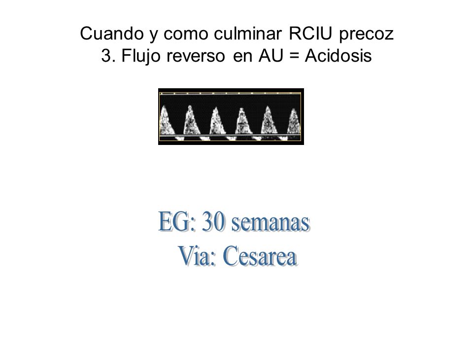 Cuando y como culminar RCIU precoz 3. Flujo reverso en AU = Acidosis