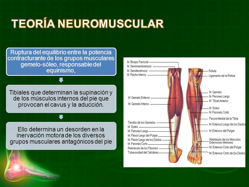 TEORÍA NEUROMUSCULAR Ruptura del equilibrio entre la potencia contracturante de los grupos musculares gemelo-sóleo, responsable del equinismo,