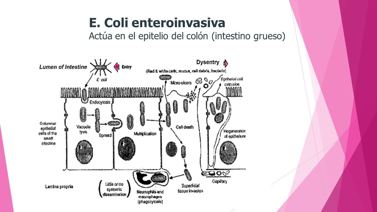 E. Coli enteroinvasiva Actúa en el epitelio del colón (intestino grueso)