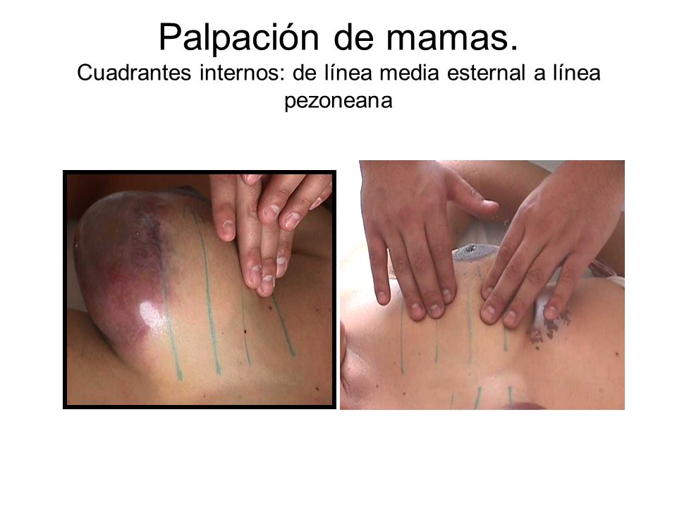 Palpación de mamas. Cuadrantes internos: de línea media esternal a línea pezoneana
