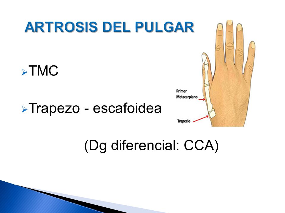 ARTROSIS DEL PULGAR TMC Trapezo - escafoidea (Dg diferencial: CCA)