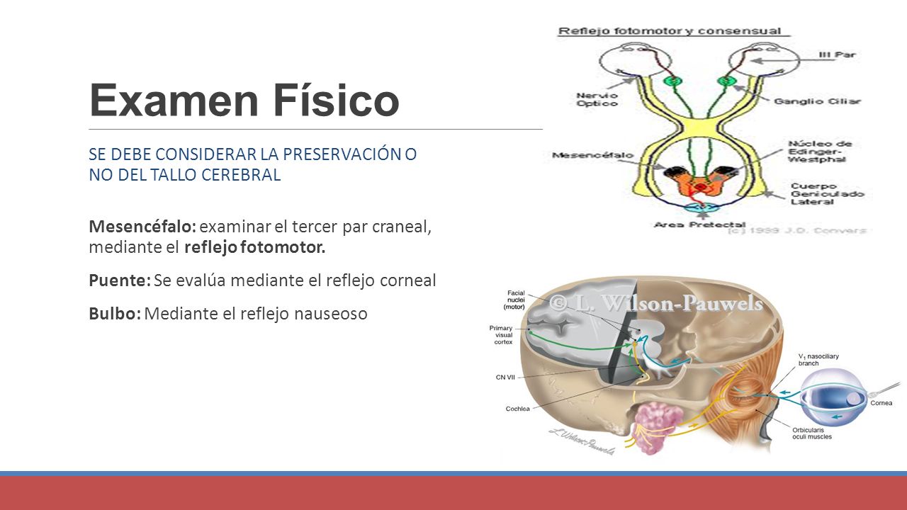 Examen Físico Se debe considerar la preservación o no del tallo cerebral.