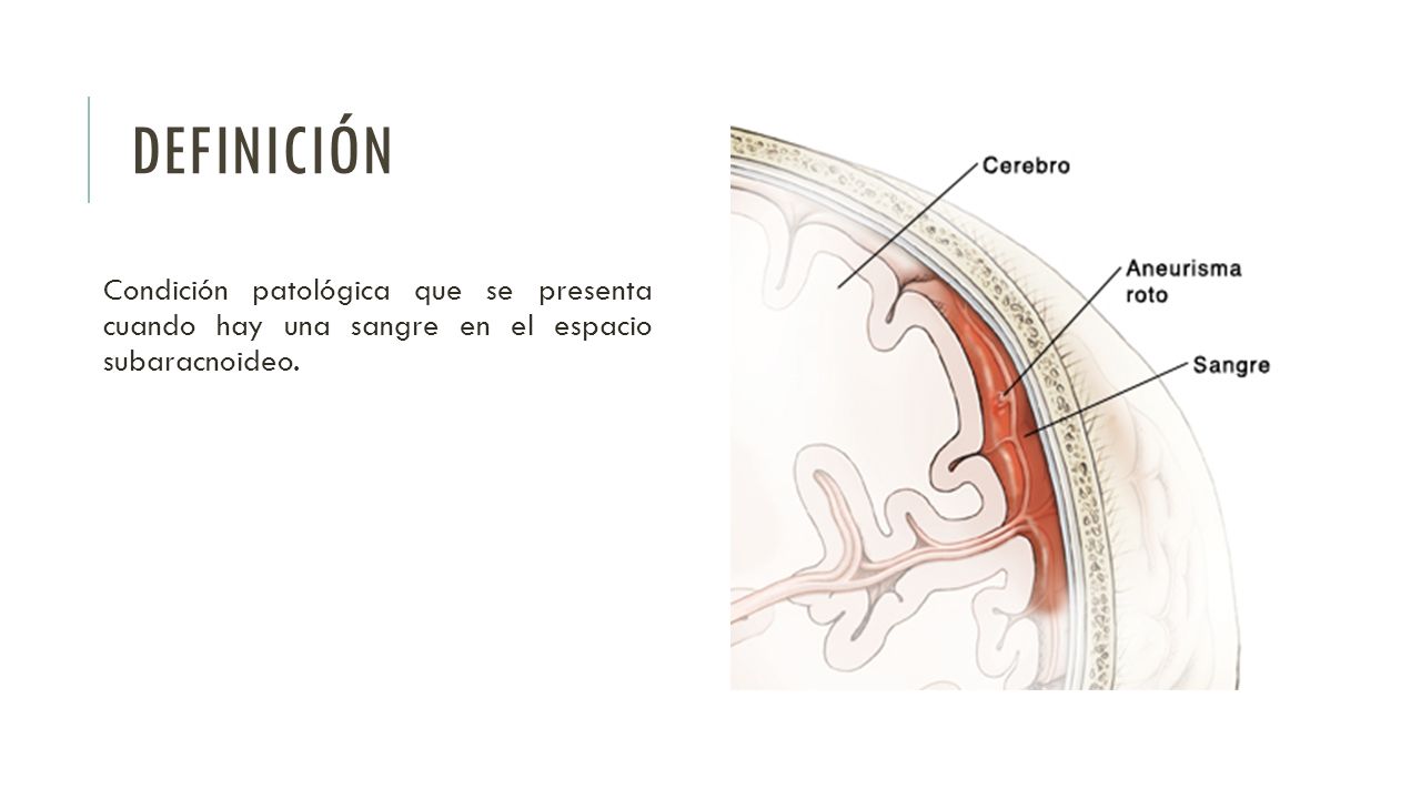 Definición Condición patológica que se presenta cuando hay una sangre en el espacio subaracnoideo.