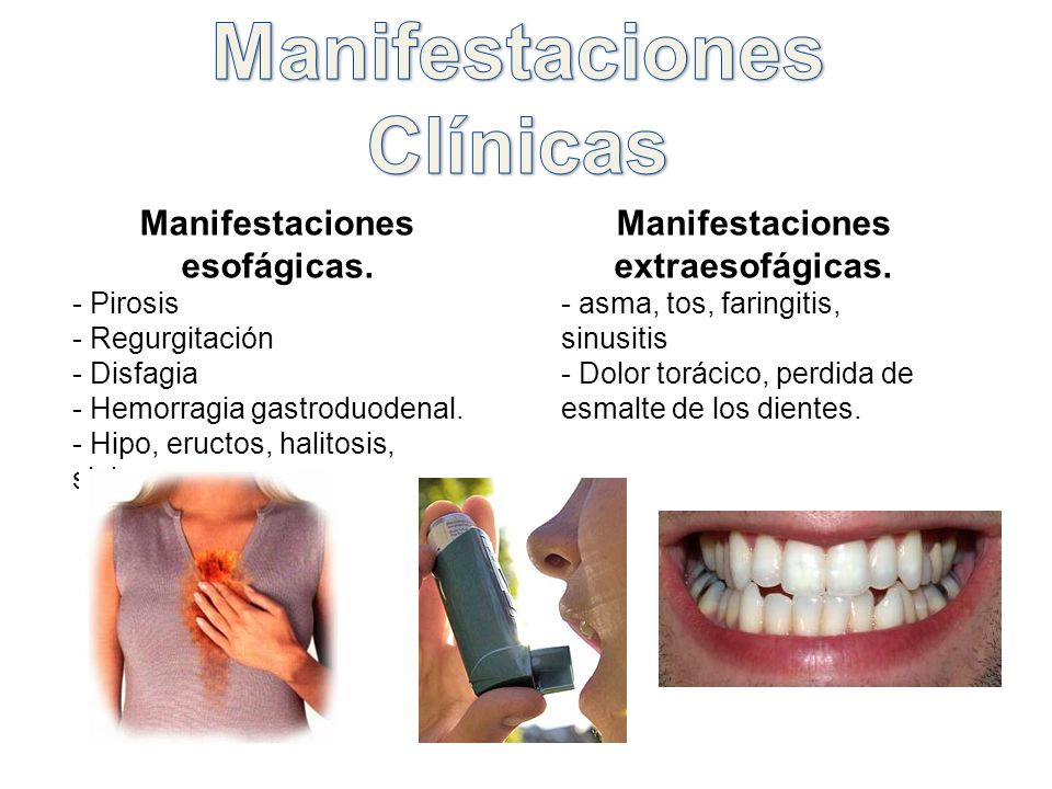 Manifestaciones Clínicas