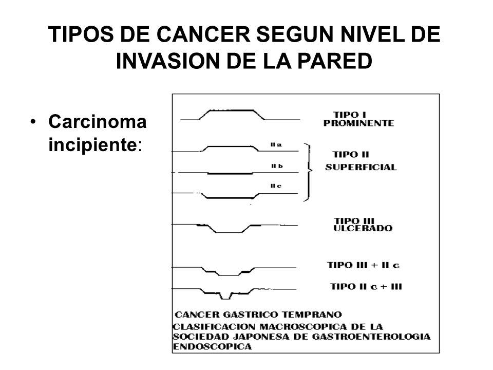TIPOS DE CANCER SEGUN NIVEL DE INVASION DE LA PARED