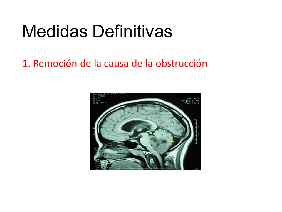 Medidas Definitivas 1. Remoción de la causa de la obstrucción