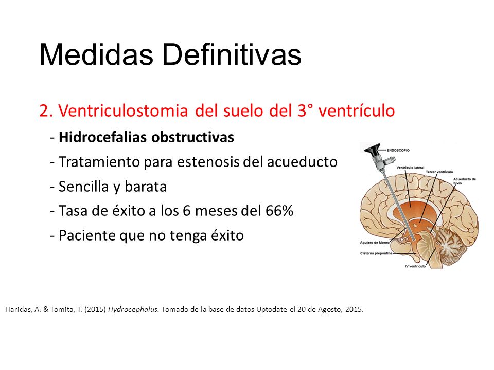 Medidas Definitivas 2. Ventriculostomia del suelo del 3° ventrículo
