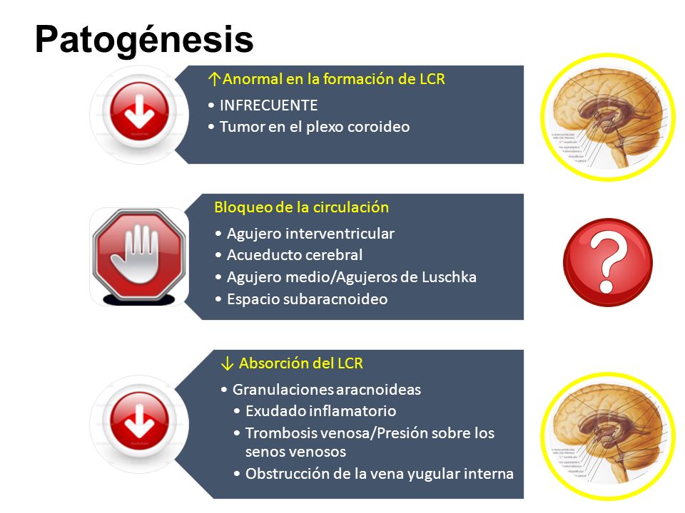 Patogénesis ↑Anormal en la formación de LCR INFRECUENTE
