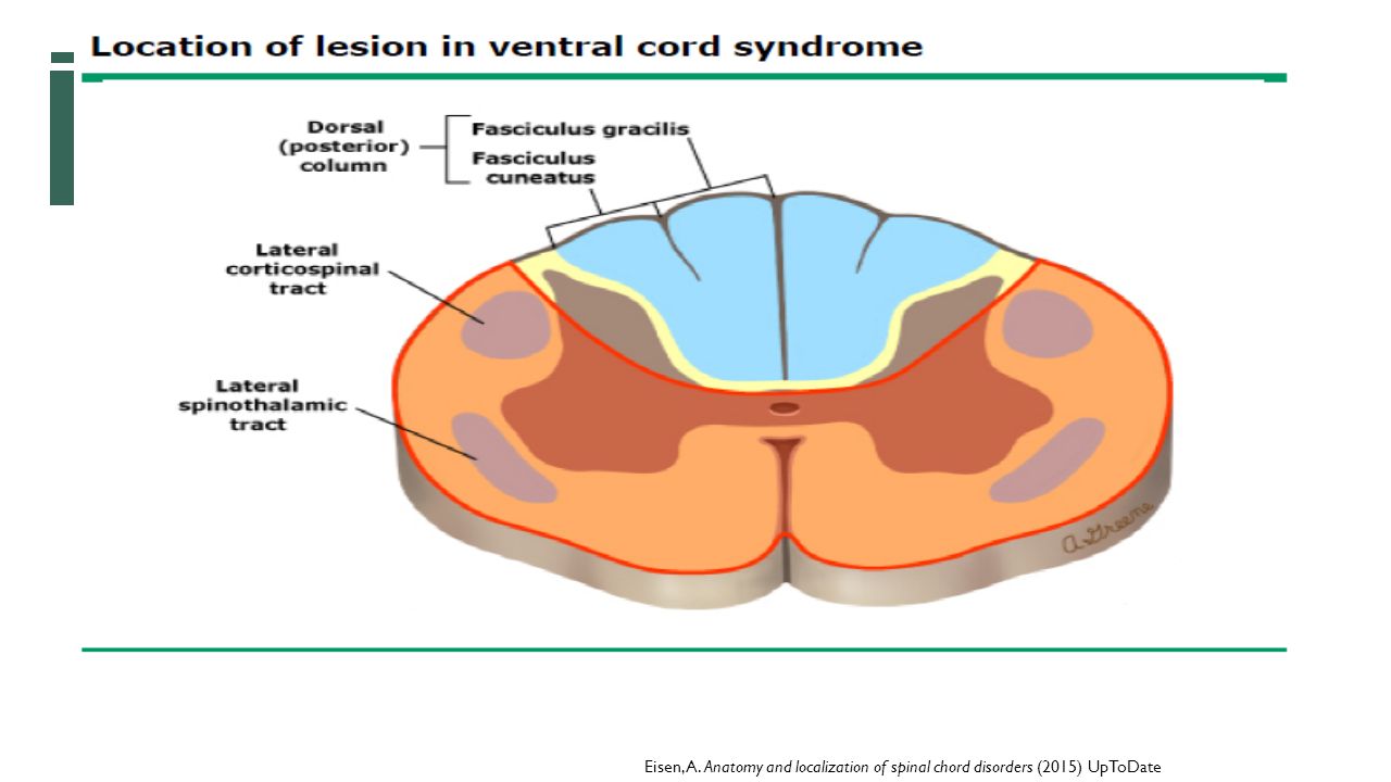 Eisen, A. Anatomy and localization of spinal chord disorders (2015) UpToDate