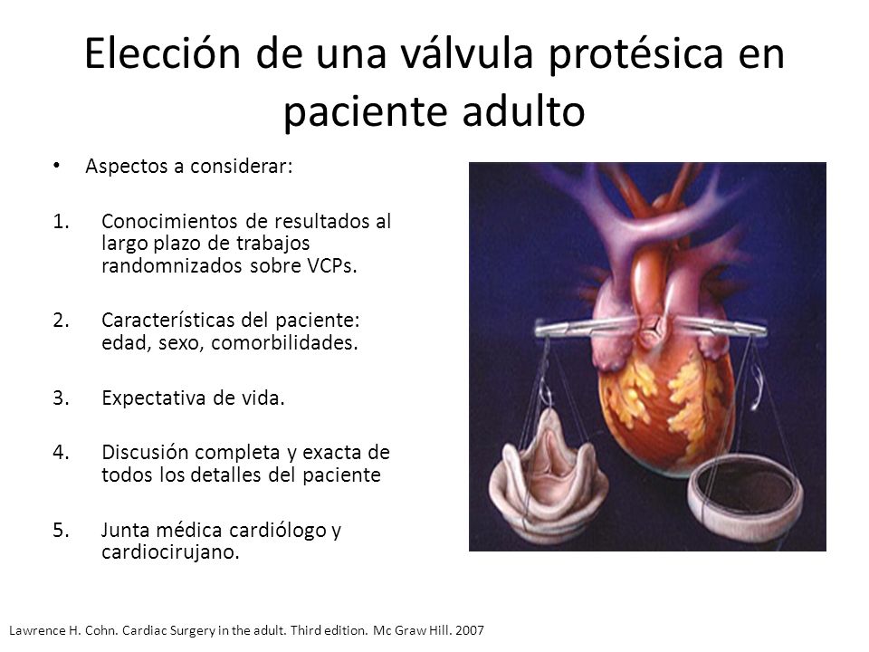 Elección de una válvula protésica en paciente adulto