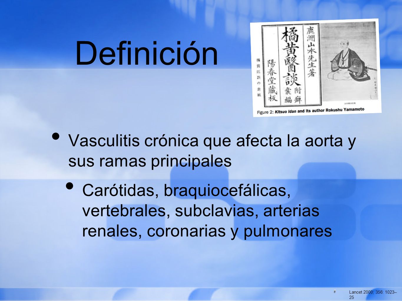 Definición Vasculitis crónica que afecta la aorta y sus ramas principales.