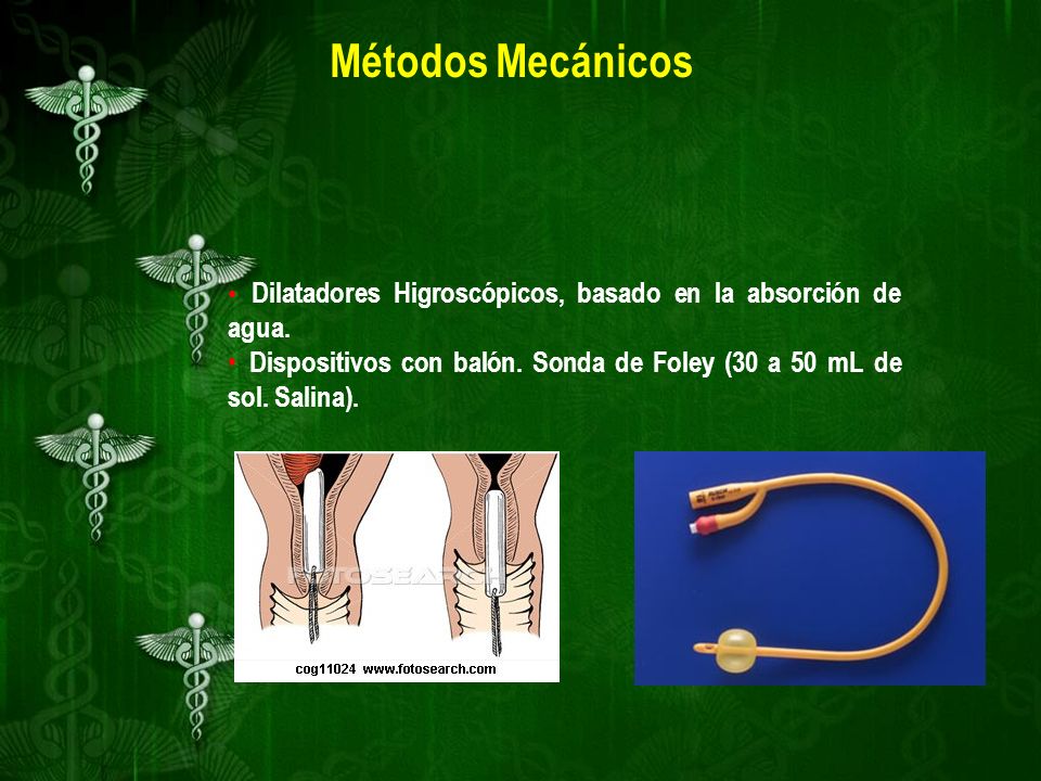 Métodos Mecánicos Dilatadores Higroscópicos, basado en la absorción de agua.