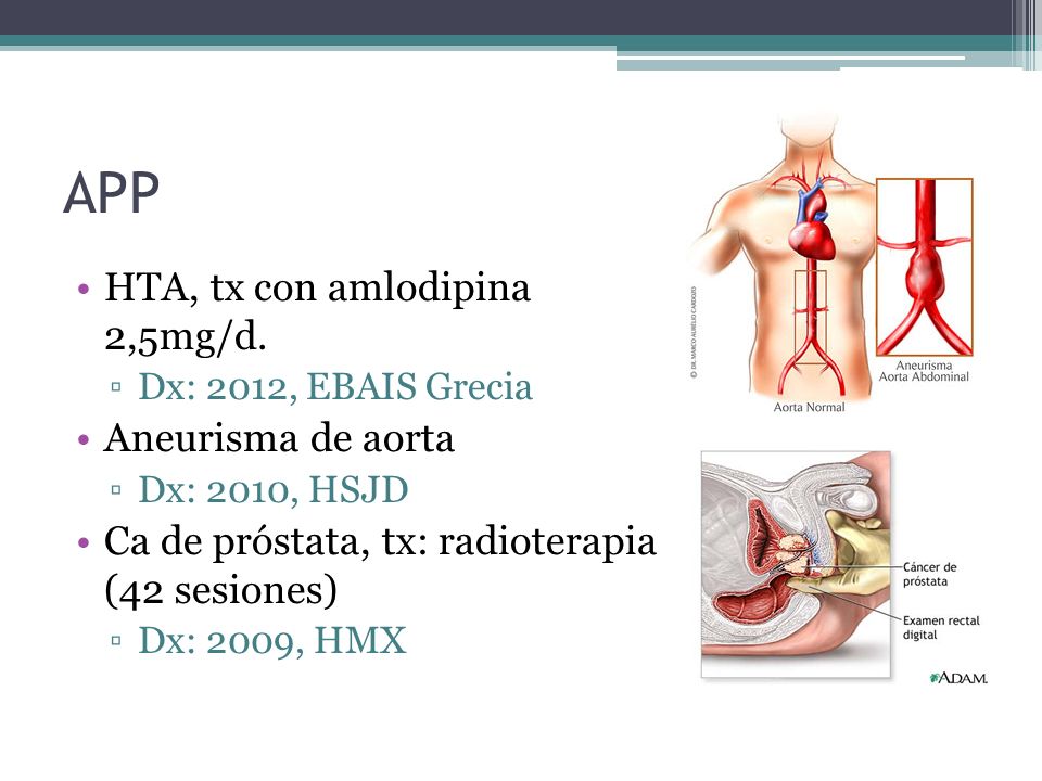 APP HTA, tx con amlodipina 2,5mg/d. Aneurisma de aorta