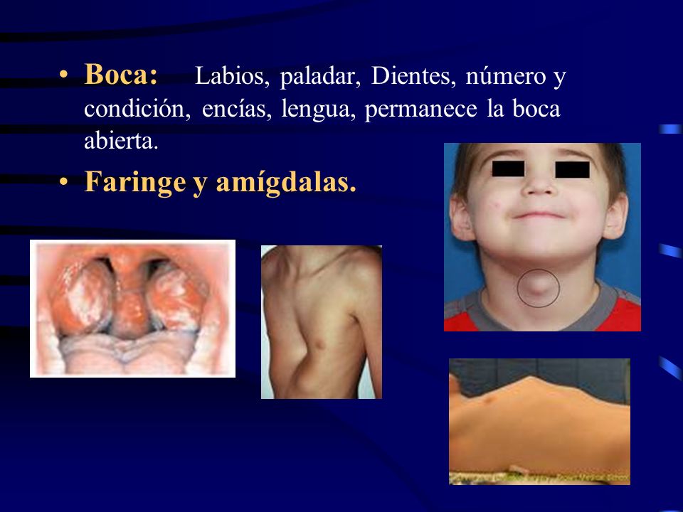 Boca: Labios, paladar, Dientes, número y condición, encías, lengua, permanece la boca abierta.