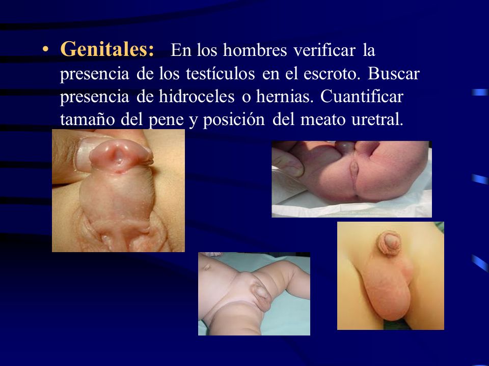 Genitales: En los hombres verificar la presencia de los testículos en el escroto.