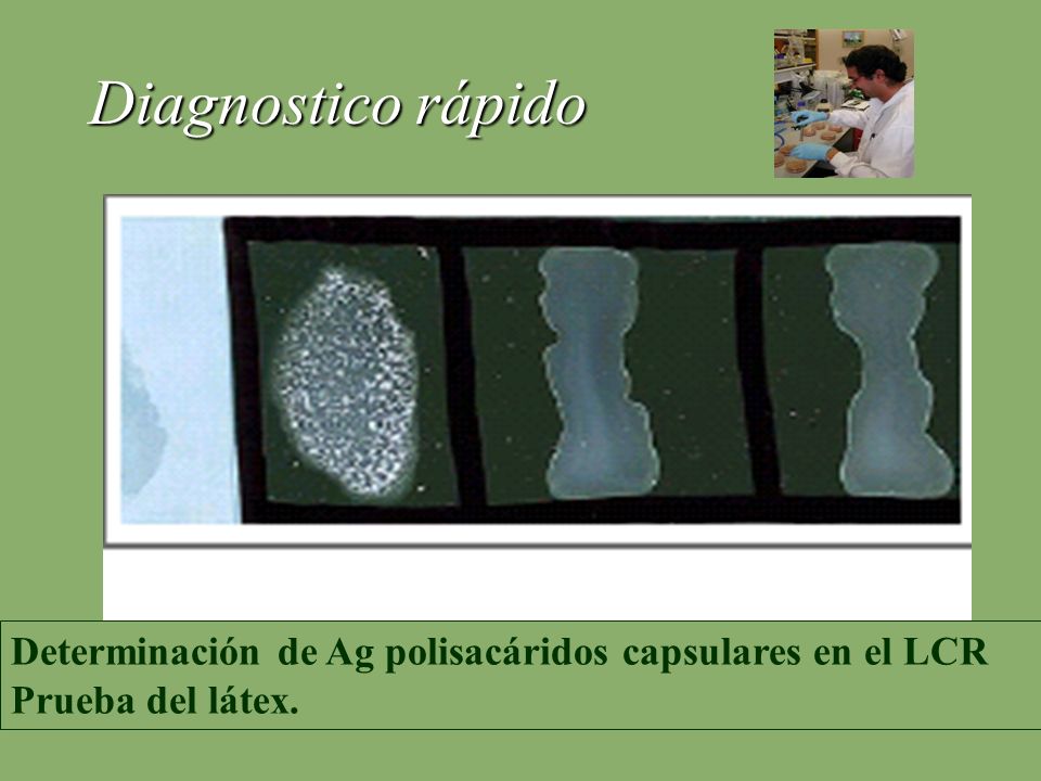 Diagnostico rápido Determinación de Ag polisacáridos capsulares en el LCR Prueba del látex.