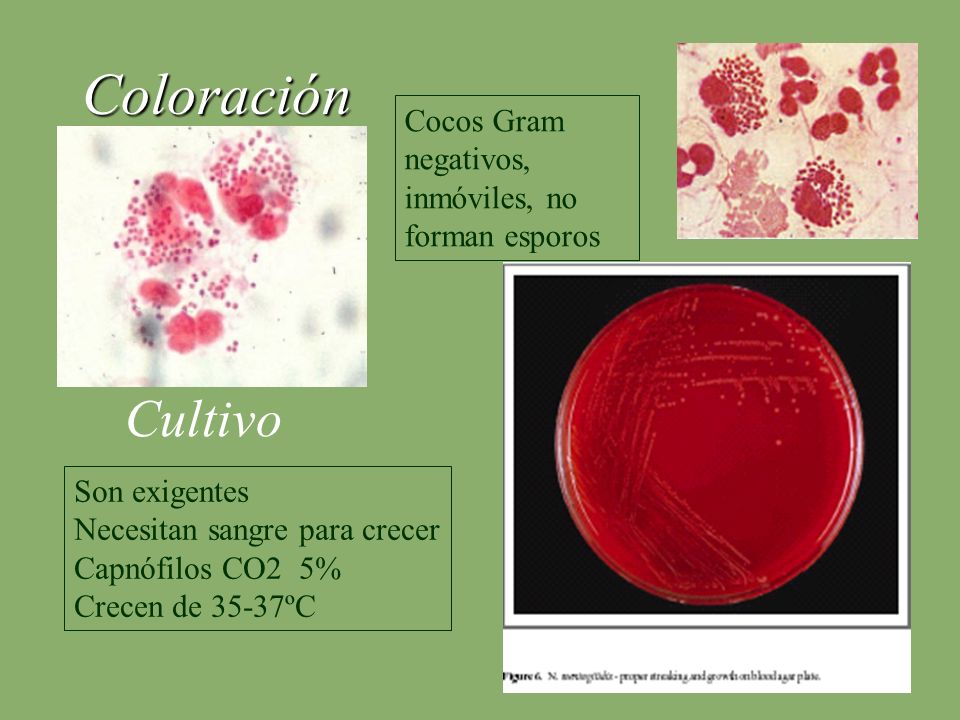 Coloración Cultivo Cocos Gram negativos, inmóviles, no forman esporos