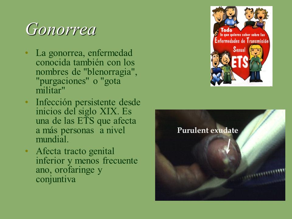 Gonorrea La gonorrea, enfermedad conocida también con los nombres de blenorragia , purgaciones o gota militar