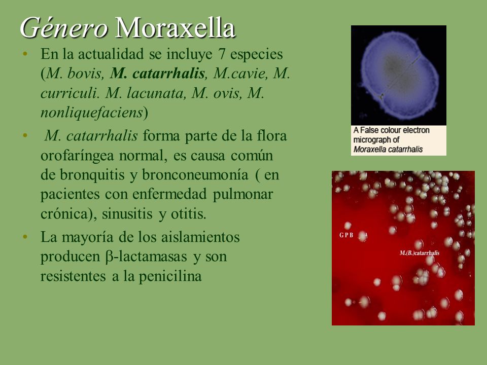 Género Moraxella En la actualidad se incluye 7 especies (M. bovis, M. catarrhalis, M.cavie, M. curriculi. M. lacunata, M. ovis, M. nonliquefaciens)