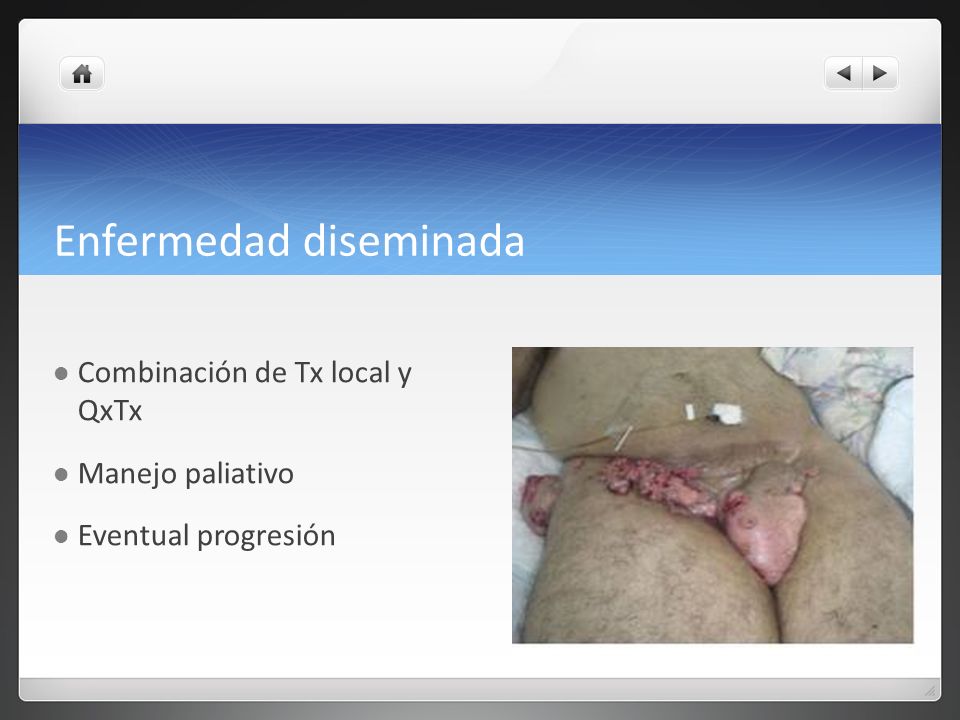 Enfermedad diseminada