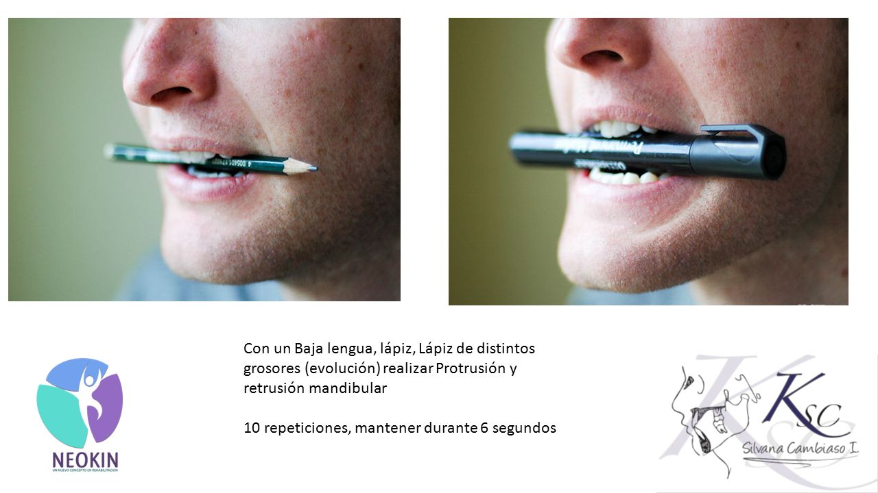 Con un Baja lengua, lápiz, Lápiz de distintos grosores (evolución) realizar Protrusión y retrusión mandibular