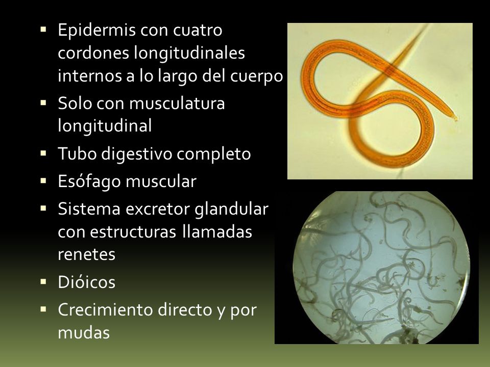 Epidermis con cuatro cordones longitudinales internos a lo largo del cuerpo