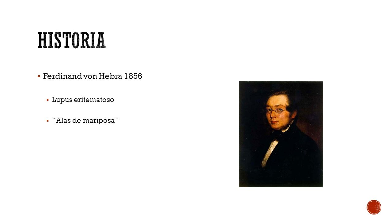 historia Ferdinand von Hebra 1856 Lupus eritematoso Alas de mariposa