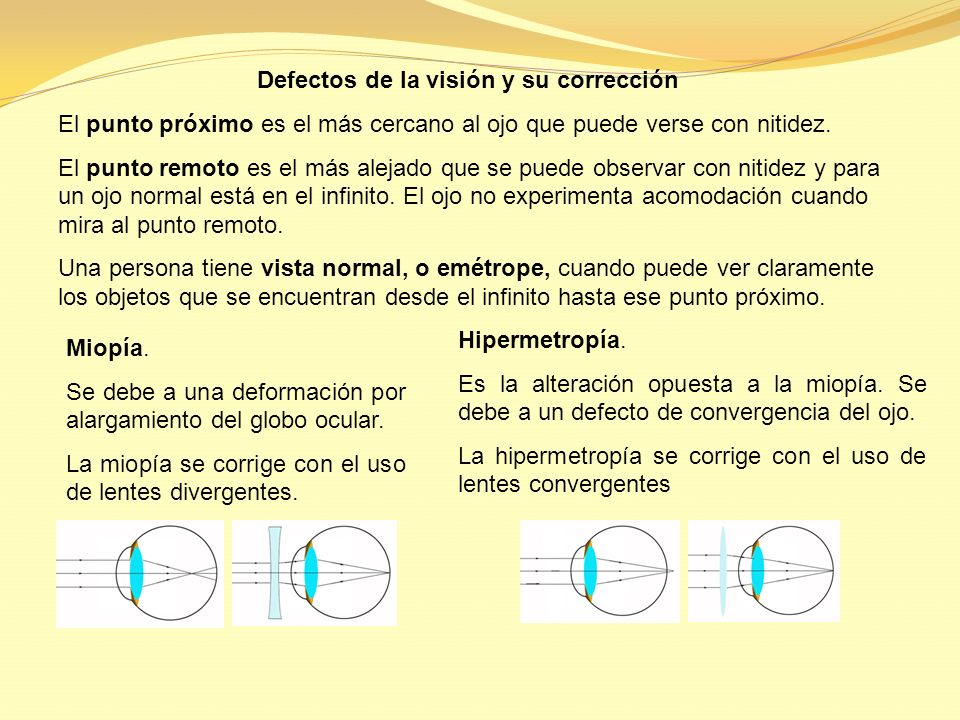 Defectos de la visión y su corrección