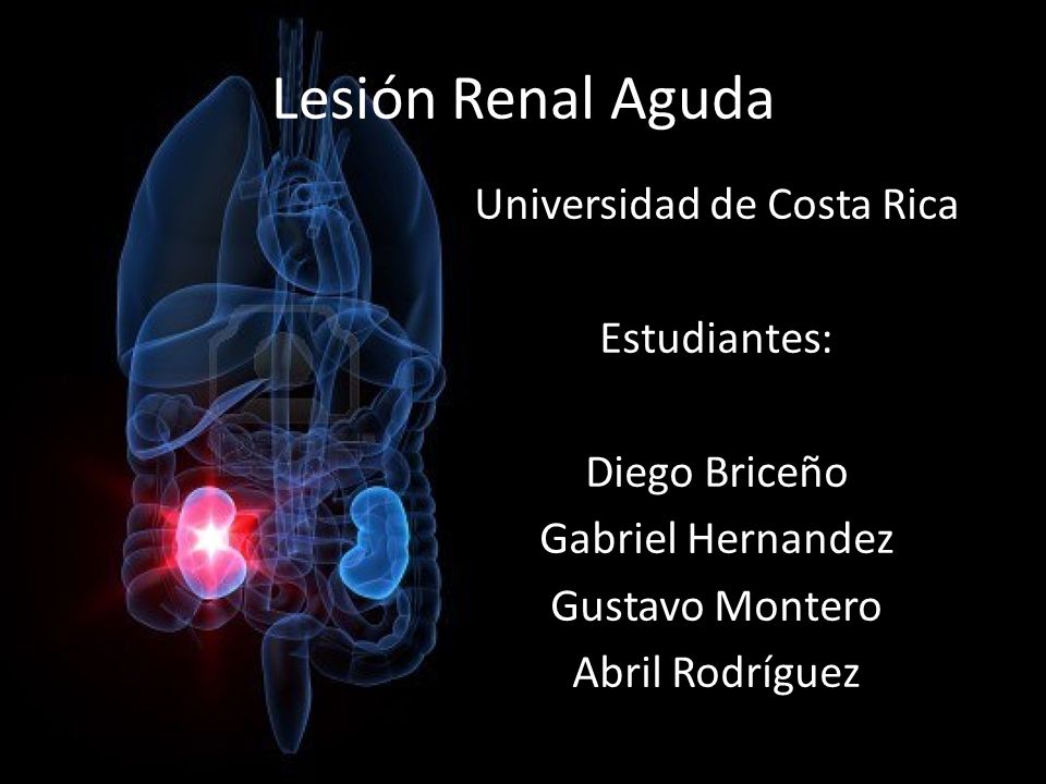 Lesión Renal Aguda Universidad de Costa Rica Estudiantes: Diego Briceño Gabriel Hernandez Gustavo Montero Abril Rodríguez