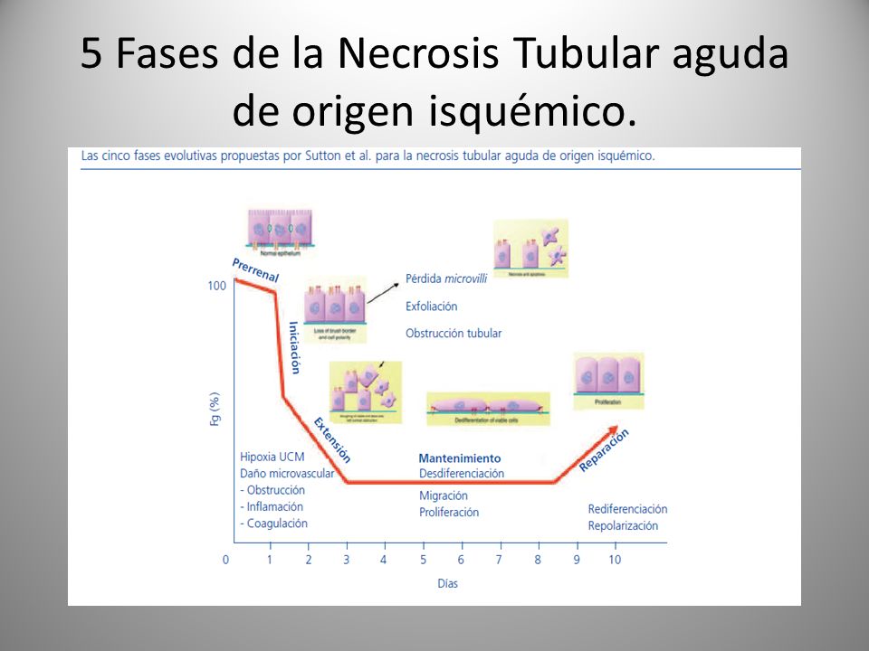 5 Fases de la Necrosis Tubular aguda de origen isquémico.