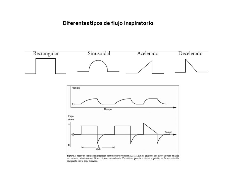 Diferentes tipos de flujo inspiratorio